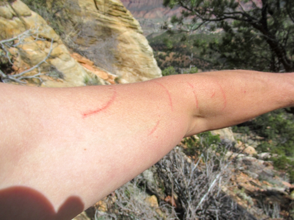 Scratches from plants on the trail to Mt. Kinesava.